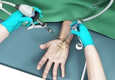 Elective Emergency Hand Surgery