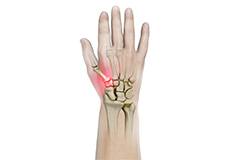LRTI for Thumb CMC Arthritis
