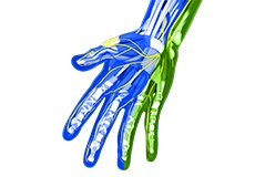 Peripheral Nerve Repair
