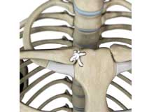 SC Joint Injury Reconstruction